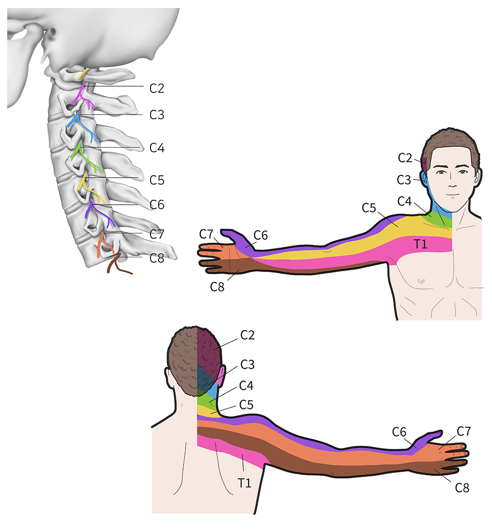 nyhed ledsage Predictor Pinched Nerves Don't Have To Be A ”Pain In Your Neck”! | Physio Performance