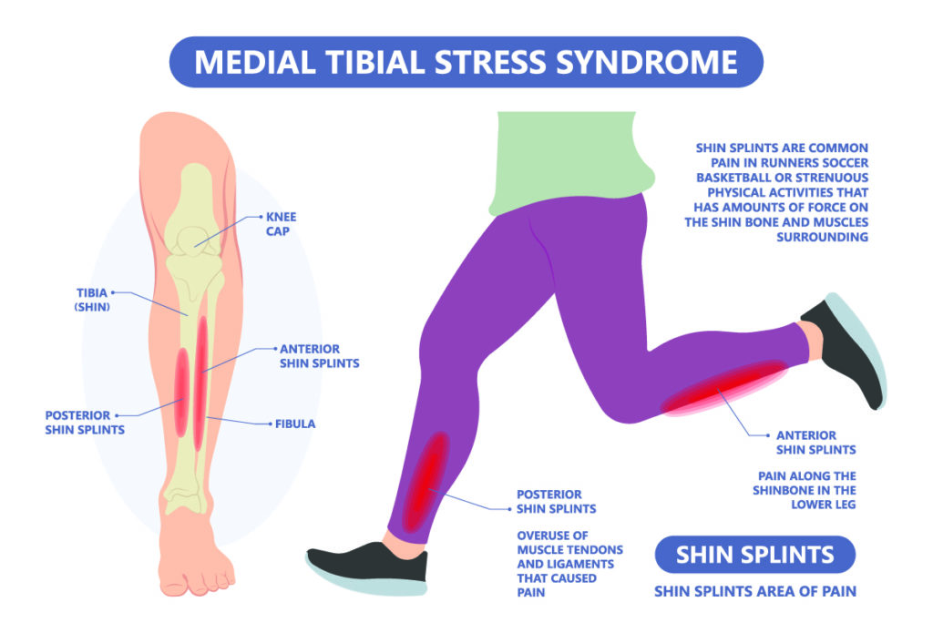 Foot and Ankle Pain - ResilientRx