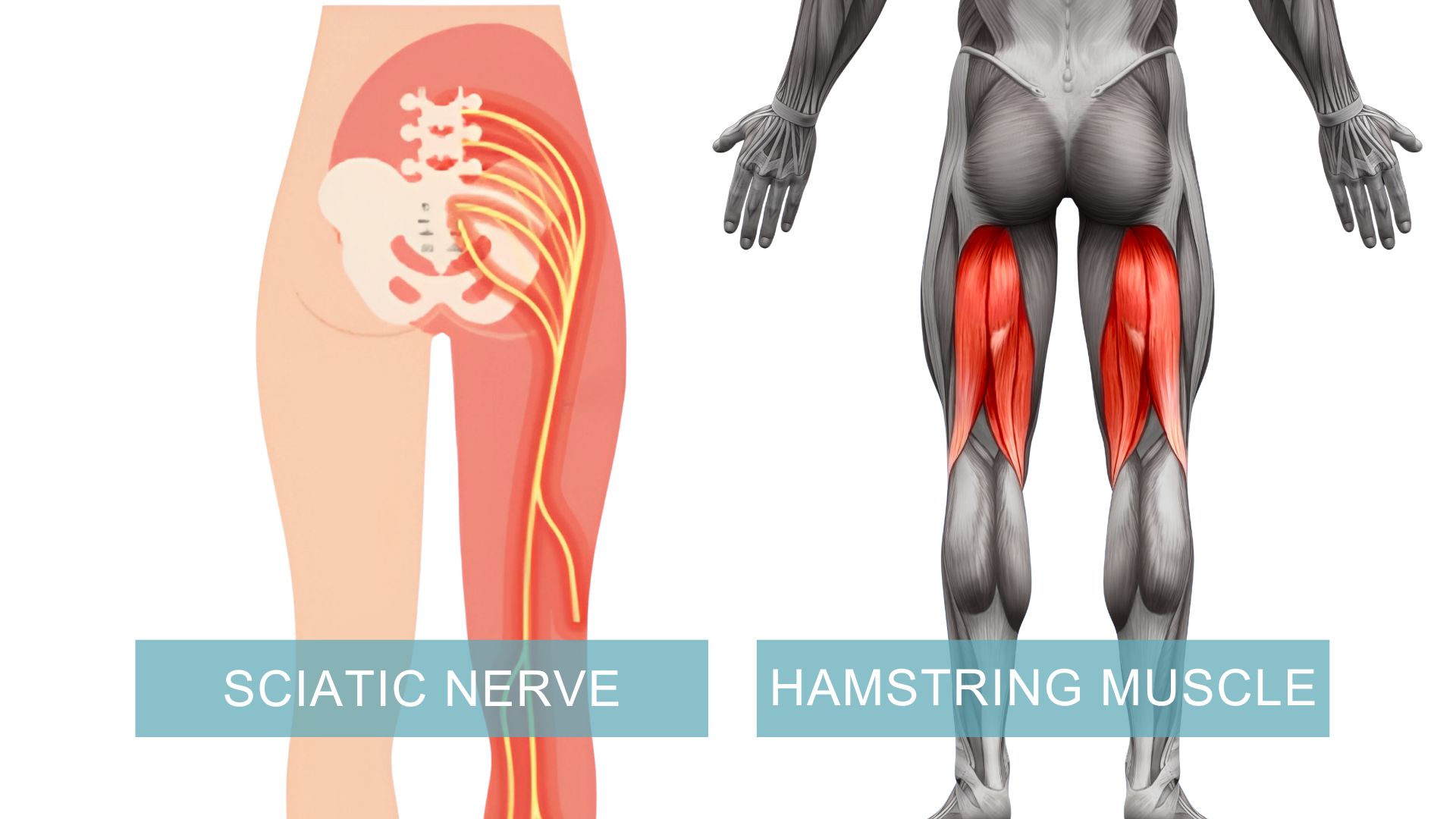 Are Your Tight Hamstrings Actually a Sign of Nerve Tension?